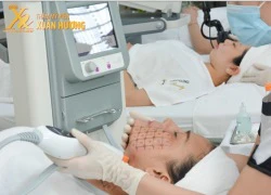 Thermage CPT xua tan nỗi lo da lão hóa