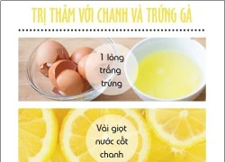 Tổng hợp các phương pháp trị vết thâm tự nhiên