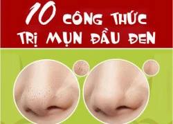 10 công thức loại bỏ mụn đầu đen tại nhà cực hay