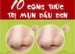 10 công thức trị mụn đầu đen không phải ai cũng biết