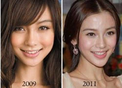 Angelababy được chứng nhận chưa từng phẫu thuật thẩm mỹ