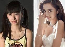 Angelababy sẽ giám định để chứng minh không &#8216;dao kéo&#8217;