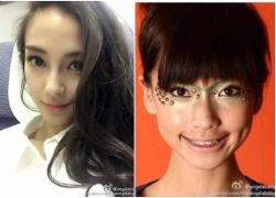 Angelababy "vịt hóa thiên nga" chỉ nhờ niềng răng