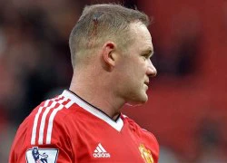 Đổ máu trong trận derby, Rooney vẫn bị mỉa mai