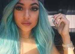 Loạt teen gặp tai họa với trào lưu "bơm môi" kiểu Kylie Jenner bằng cốc