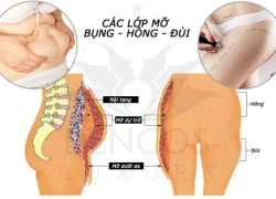 Tan mỡ bụng, đùi bằng liệu pháp sinh học