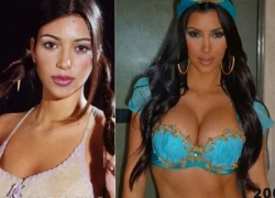 Gia đình Kim Kardashian chi 200 tỷ để dao kéo