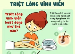 Cẩm nang giúp bạn tẩy lông bằng laser hiệu quả, an toàn