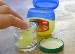 Công dụng thần kỳ của Vaseline trước 5 vấn đề hư tổn của da trong mùa hanh khô