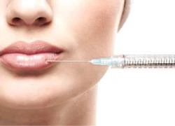 Hiểu rõ hơn về botox