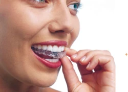 Invisalign ưu đãi đặc biệt dịp Giáng sinh