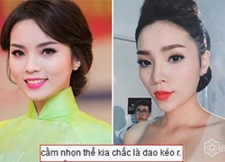 Kỳ Duyên tiếp tục bị nghi phẫu thuật thẩm mỹ vì cằm nhọn bất thường