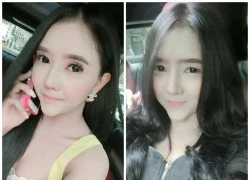 Thiếu nữ đen đúa hóa hot girl trắng ngần nhờ "dao kéo"