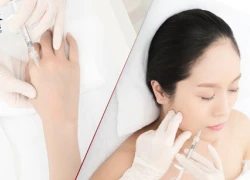 5 lý do nên làm đẹp với Vampire Facelift trước Tết