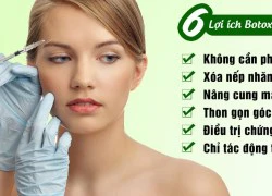 6 lợi ích thẩm mỹ của Botox có thể bạn chưa biết