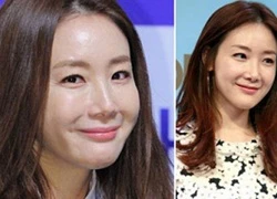 Choi Ji Woo lộ gương mặt sưng phồng khó hiểu