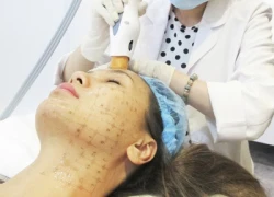 Giữ gìn làn da không tuổi với Thermage và Ultherapy