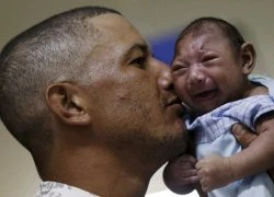 Hé lộ những sự thật khủng khiếp về virus "ăn não" Zika