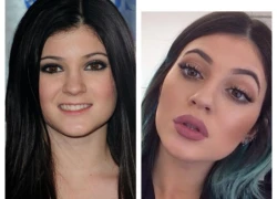 Sao Hollywood được photoshop môi dày giống Kylie Jenner