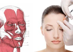 Tiêm Botox có ảnh hưởng thần kinh, làm cho mặt bị 'đơ', căng cứng