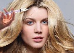 Tiêm botox vào da đầu: phương pháp mới toe làm đẹp tóc