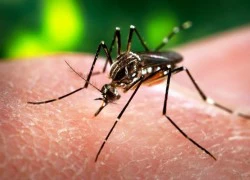 5.000 phụ nữ Colombia mang thai mắc virus Zika