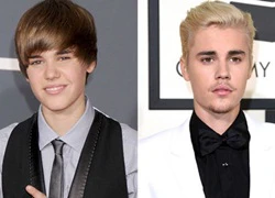 Justin Bieber thay đổi kinh ngạc sau 6 năm