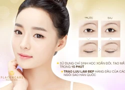 Sở hữu đôi mắt to tròn sau 15 phút bấm mí