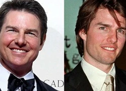 Tom Cruise dính nghi án phẫu thuật thẩm mỹ khiến mặt biến dạng