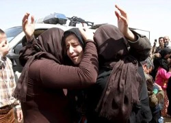 Cô gái Yazidi tự đốt mặt để không còn bị IS hãm hiếp