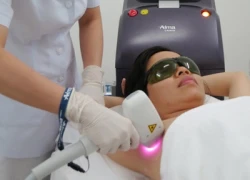 Công nghệ laser mới triệt lông không đau