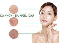 Da nhờn và mụn nên dùng sữa rửa mặt loại nào tốt nhất