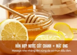 Đánh bay mụn đầu đen khó trị với các phương pháp cực đơn giản