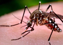 Hàn Quốc công bố ca nhiễm virus Zika đầu tiên