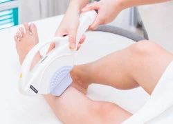 Triệt lông không đau với công nghệ IPL