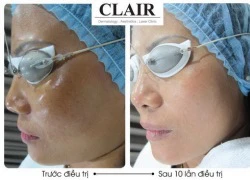 Tuần lễ ưu đãi 'Đẹp hoàn hảo' cùng Clair Clinic