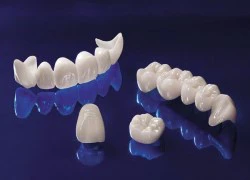 Vì sao trồng răng sứ Zirconia được nhiều người ưa chuộng?