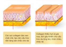 6 sự thật về Collagen