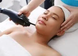 Fractional Laser CO2 giúp điều trị sẹo rỗ