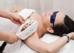 Hãy cân nhắc triệt lông bằng laser vì 9 tác dụng phụ sau