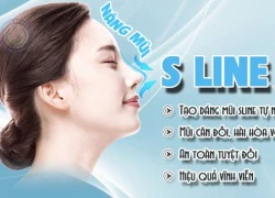 Nâng mũi S line 3D cho mũi đẹp toàn diện