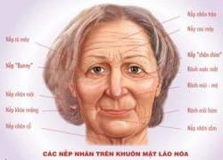 Trẻ lại nhờ Botox và Restylane