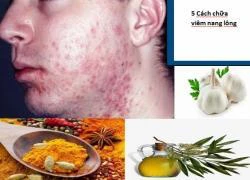 5 loại thảo mộc chữa viêm nang lông