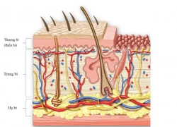 Cách điều trị các loại nám phổ biến