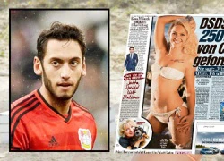 Calhanoglu đánh bồ đến... trụy thai