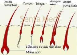 Chuẩn bị mang thai có nên triệt lông?