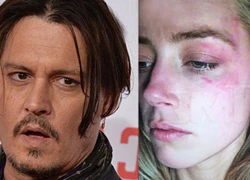 Johnny Depp tố vợ dựng chuyện bạo hành để được chia tài sản