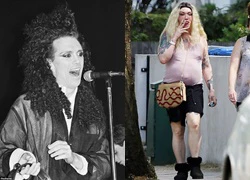 Khuôn mặt đáng sợ của ca sĩ nghiện &#8216;dao kéo&#8217; Pete Burns