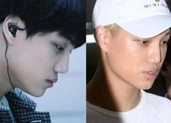 Lại rộ lên loạt hình ảnh nghi vấn Kai (EXO) đã phẫu thuật thẩm mỹ mũi