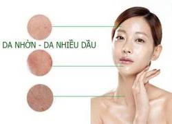 Làm thế nào để da hết nhờn và mụn đầu đen?